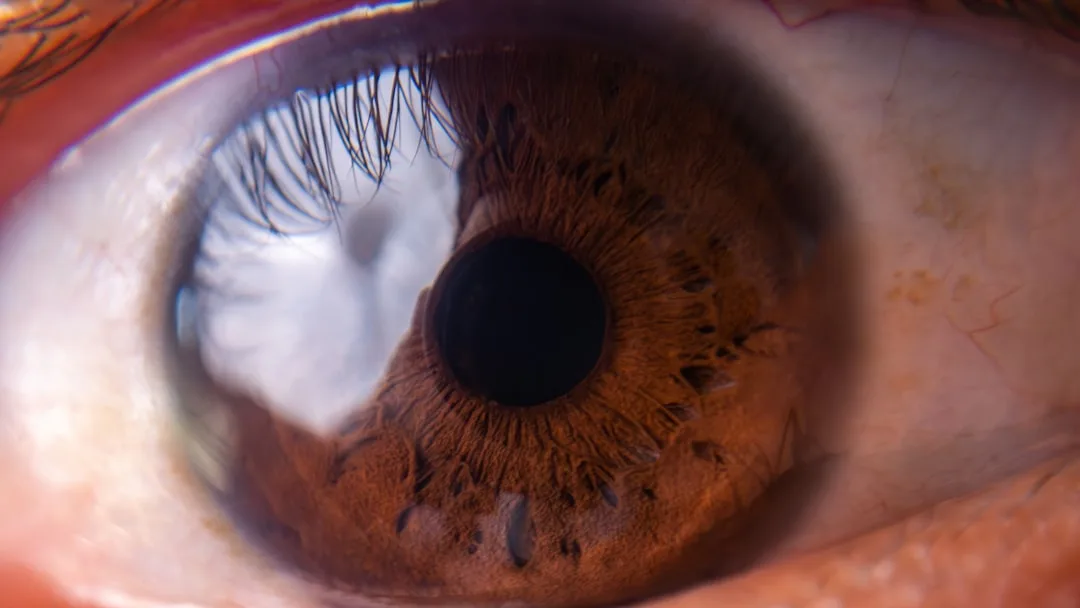 a close up view of a human eye