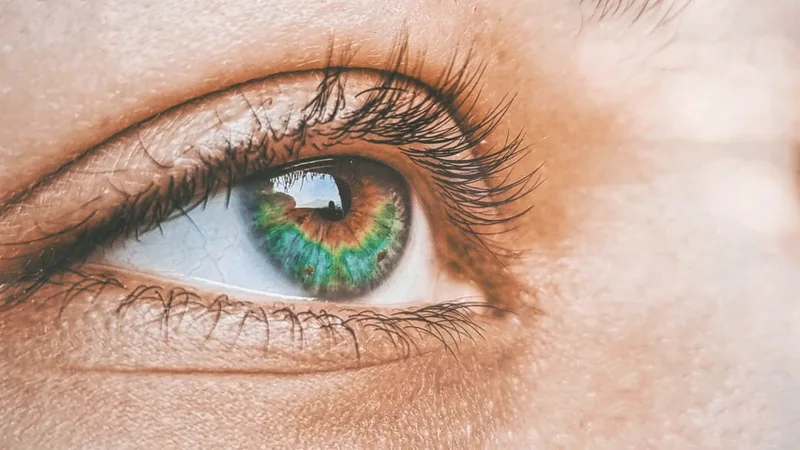 LASIK vs. LASEK in Korea: Which Eye Surgery Is Right for You?