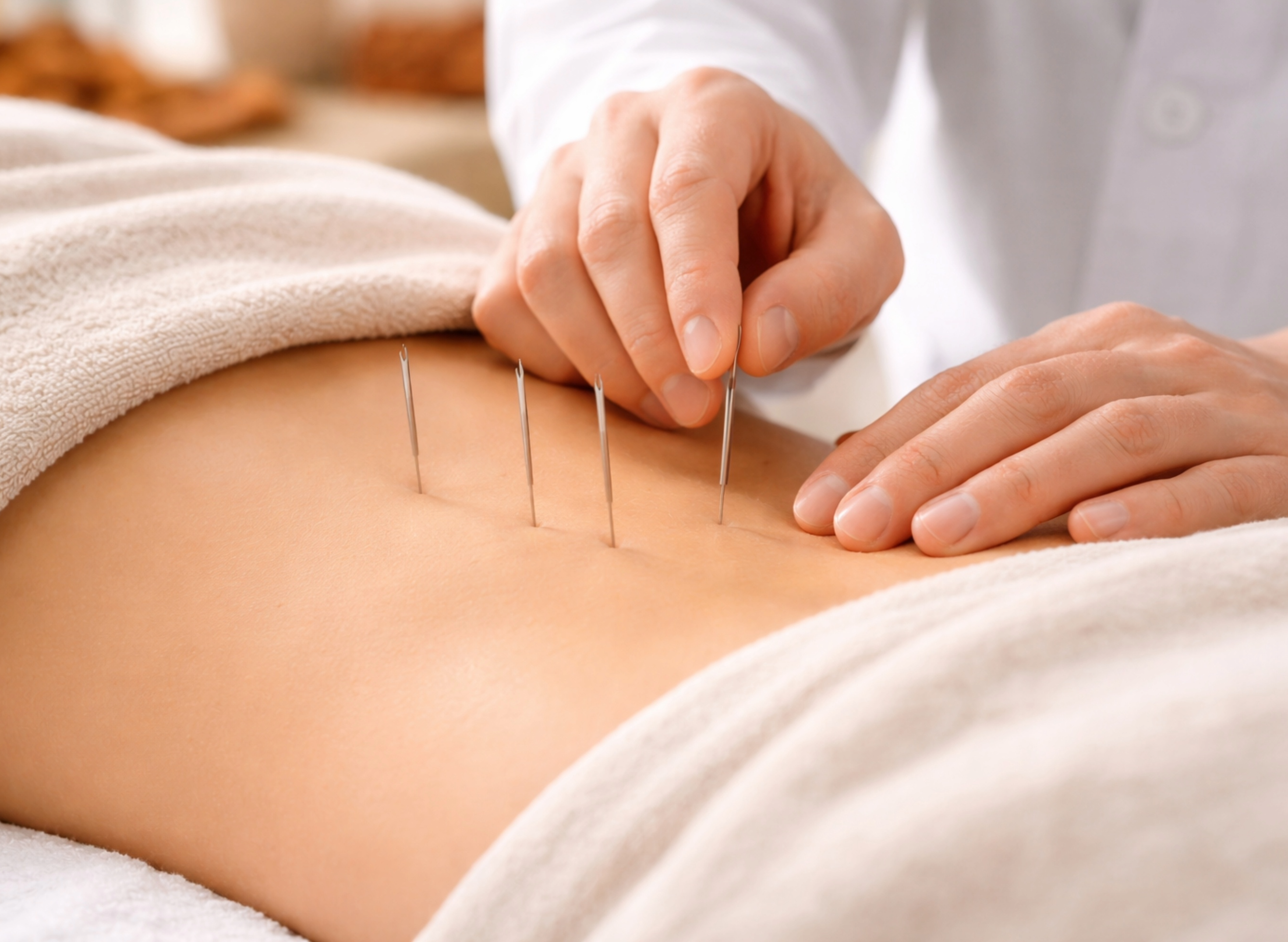Korean Acupuncture