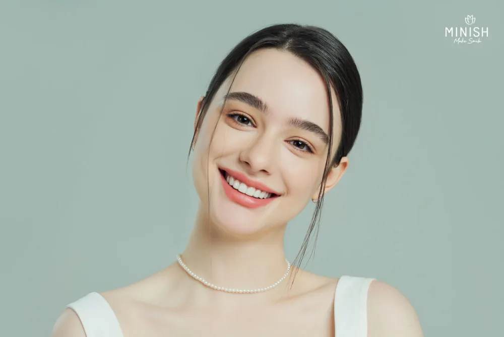 Minish One-Day Veneers