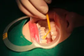 Gum Protection