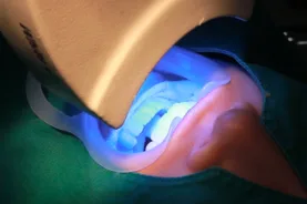 Whitening Ray