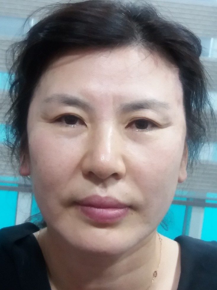 After