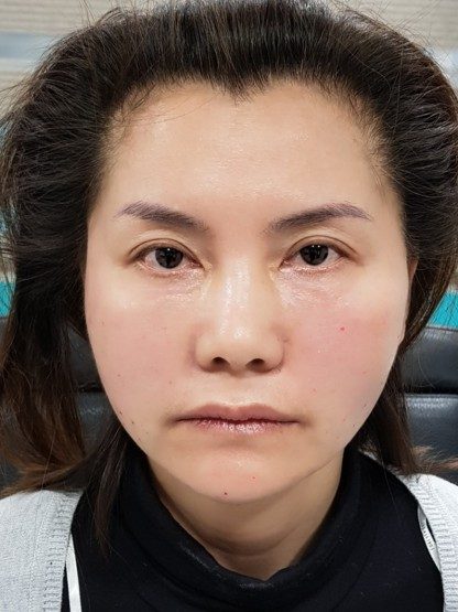 After