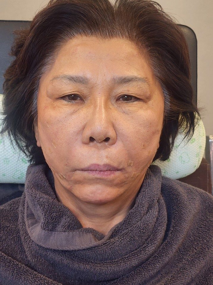After